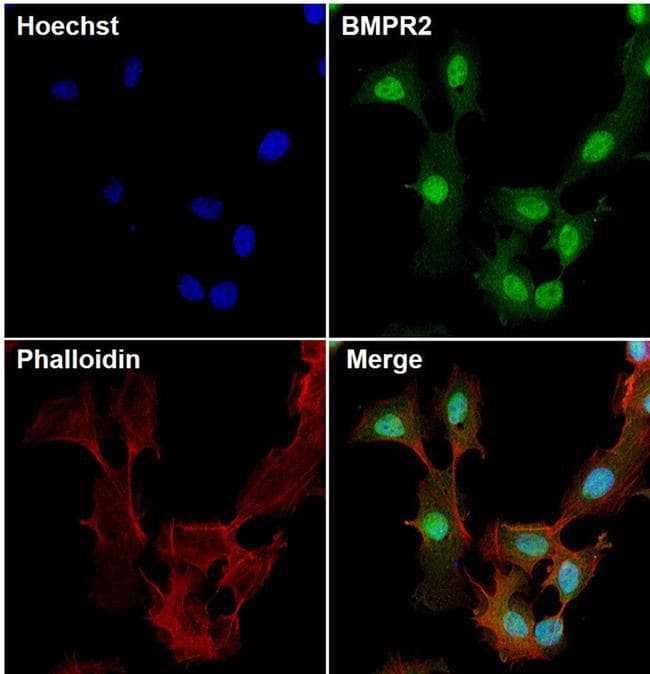 BMPR2 Antibody (clone 3F6F8)