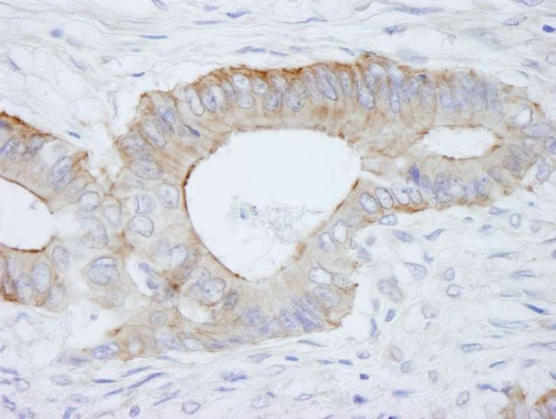 SPTBN1 / ELF Antibody (aa2150-2200)