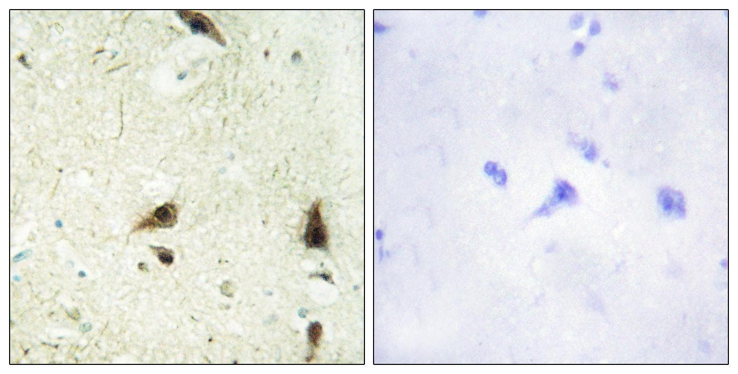 Polyclonal Rabbit anti-Human CHRAC1 Antibody (IHC)