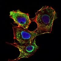 SMAD3 Antibody (clone 5G11)
