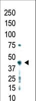 Polyclonal Rabbit anti-Human PRMT2 Antibody (aa344-375, WB)