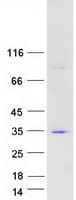 Human SYNGR2 / Synaptogyrin 2 Protein (Recombinant Myc-DDK (Flag))