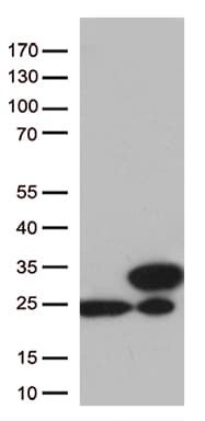 TAGLN2 / Transgelin 2 Antibody (clone OTI7A5)