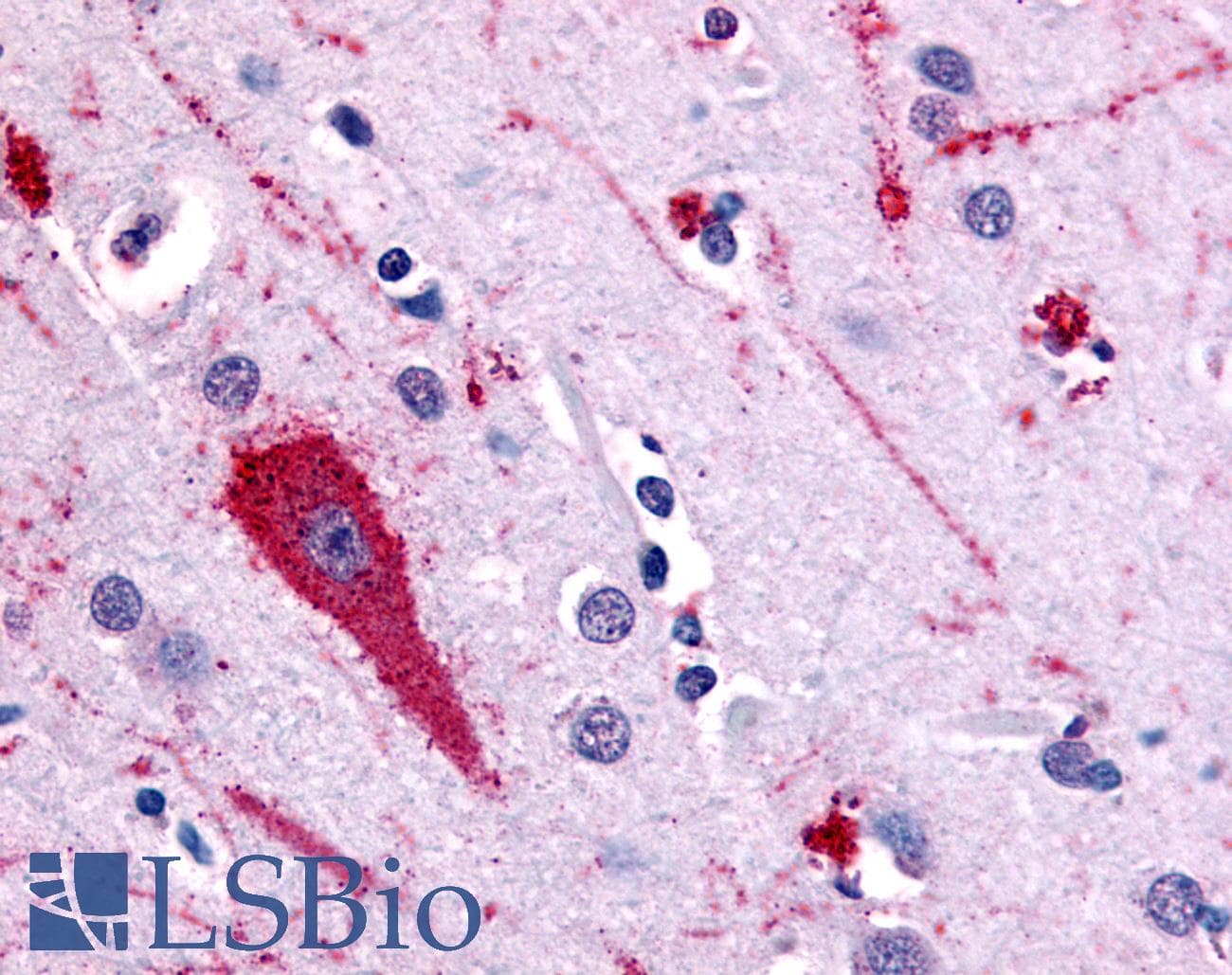 PathPlus™ Polyclonal Rabbit anti-Human HTR5A / 5-HT5A Receptor Antibody (Extracellular Domain, IHC)
