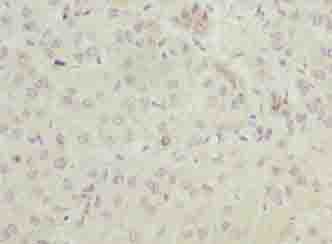 ELOVL2 Antibody