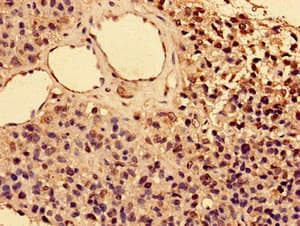 IL2RA / CD25 Antibody