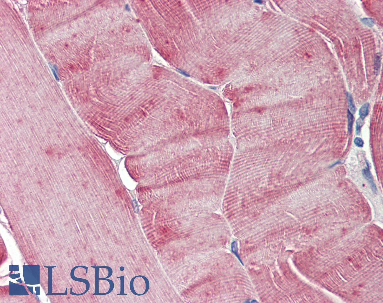 IHC-plus™ AURKA / Aurora-A Antibody (clone 7A3)