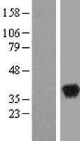 WDR5 Protein (Over-Expression Lysate Myc-DDK (Flag))