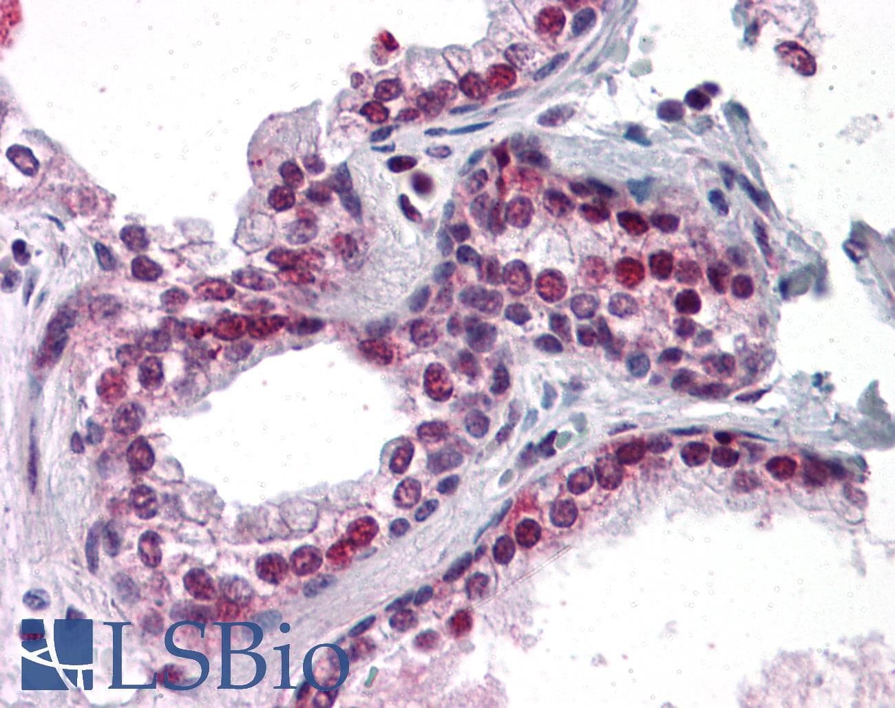 IHC-plus™ Polyclonal Rabbit anti-Human FRMPD3 Antibody (IHC, IF, WB)