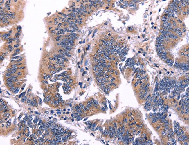 Polyclonal Rabbit anti-Human ARC / Arg3.1 Antibody (IHC)