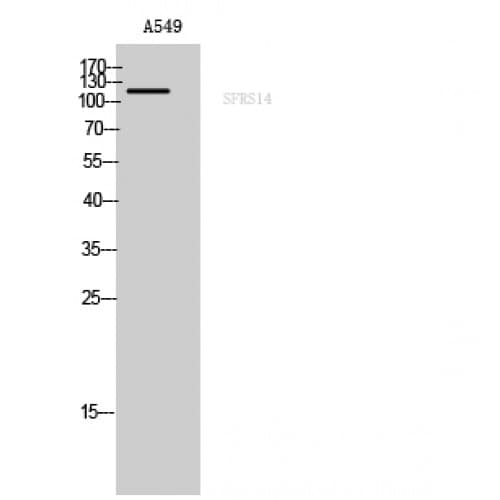 SUGP2 / SFRS14 Antibody (260-340 aa, Internal)