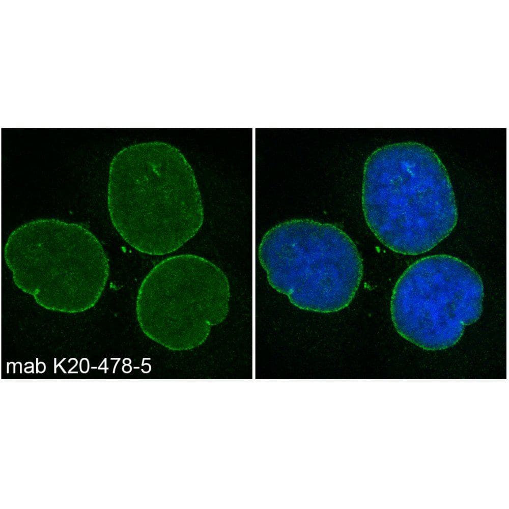 Monoclonal Mouse anti-Human SYNE2 / Nesprin-2 Antibody (clone K20-478-5, IF, WB)