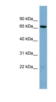 HP1BP3 Antibody (aa71-120)