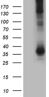AQP8 / Aquaporin 8 Antibody (clone OTI6E6, Carrier-free)