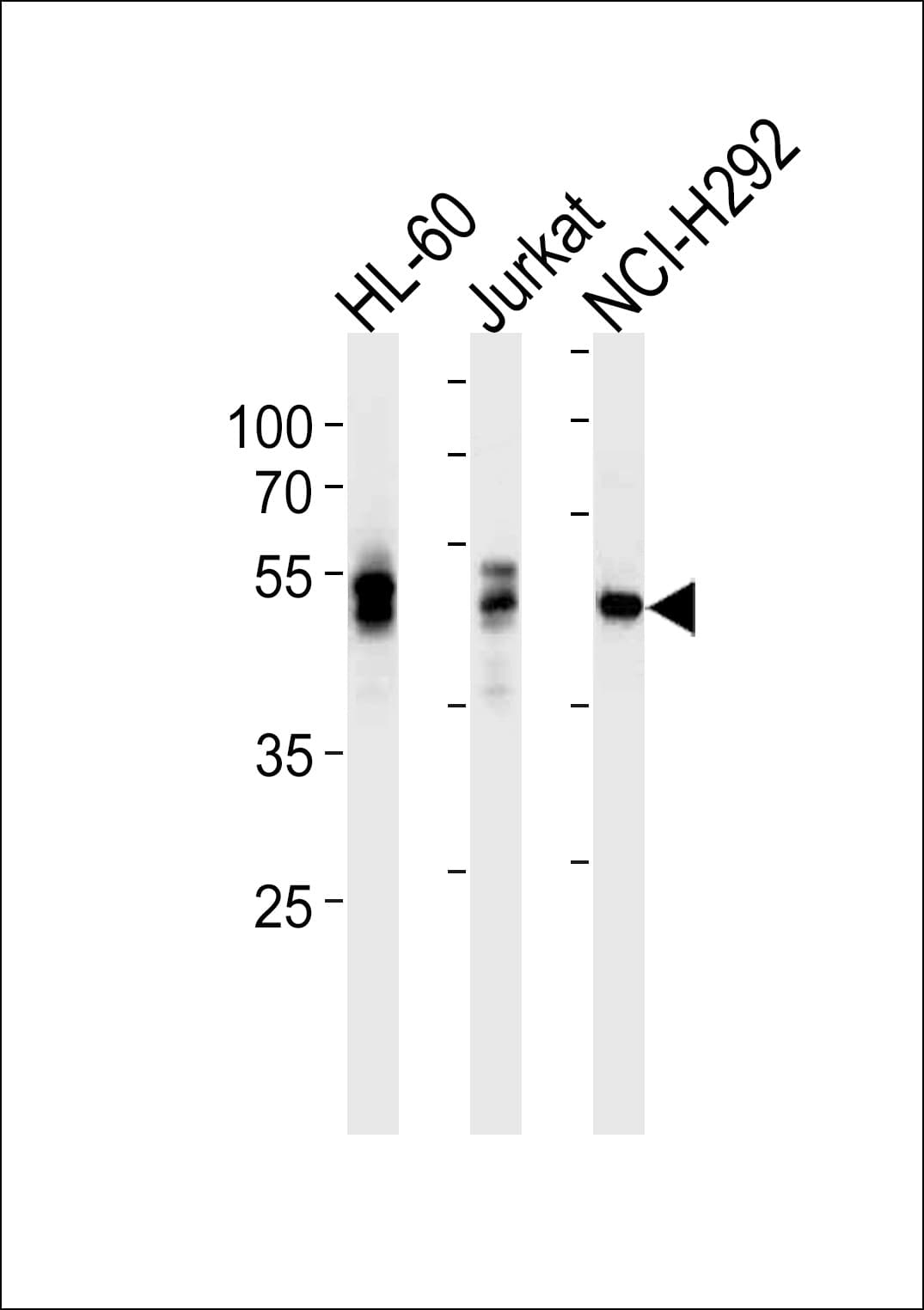 Monoclonal Mouse anti-Human p56lck / LCK Antibody (clone 845CT3.5.2, WB)