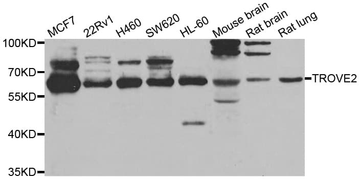 Polyclonal Rabbit anti-Human TROVE2 Antibody (IHC, WB)