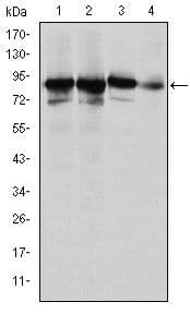 XRCC5 / Ku80 Antibody (clone 5C5)