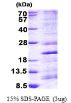 Human RPS13 / Ribosomal Protein S13 (Recombinant His)