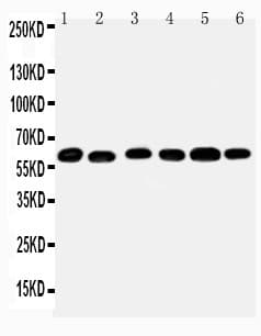 MAOB / Monoamine Oxidase B Antibody (aa42-56)