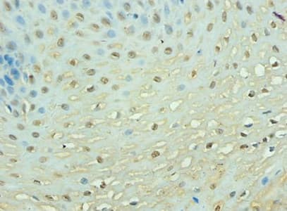 PTEN Antibody