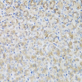 ARFGAP3 Antibody (AP)
