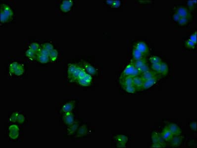 ATP2A1 / SERCA1 Antibody