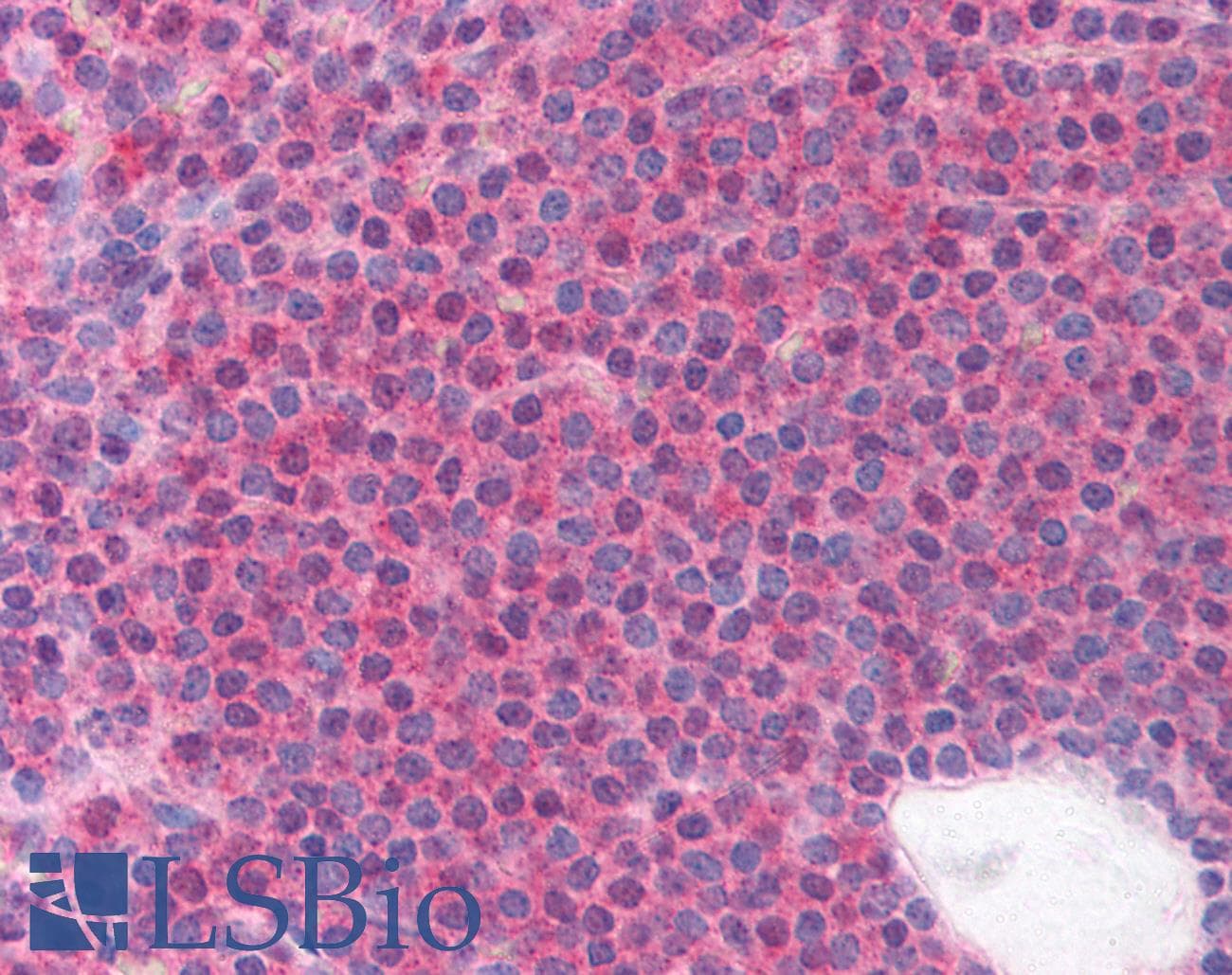 IHC-plus™ Polyclonal Rabbit anti-Human LRRC3B Antibody (aa245-259, IHC)