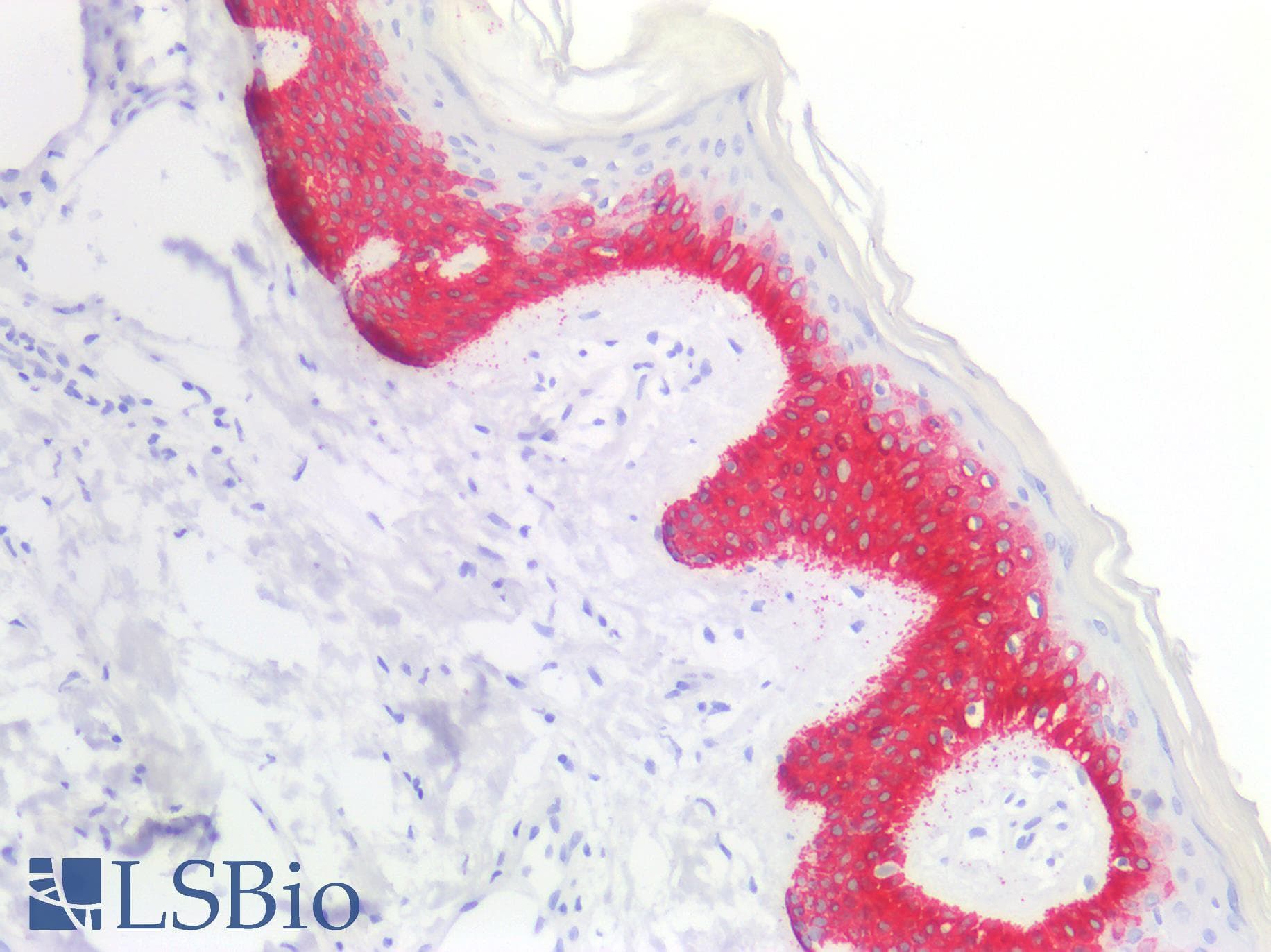 IHC-plus™ Monoclonal Mouse anti-Human KRT14 / CK14 / Cytokeratin 14 Antibody (clone AT13F4, IHC, IF, WB)
