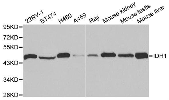 Polyclonal Rabbit anti-Human IDH1 / IDH Antibody (IHC, IF, WB)