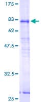 Human SRPX Protein (Recombinant GST)