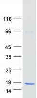 Human ATP6V1G2 Protein (Recombinant Myc-DDK (Flag))