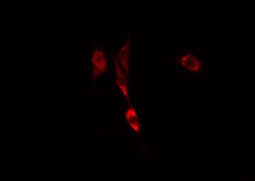 Polyclonal Rabbit anti-Human ARF6 Antibody (IF, WB)