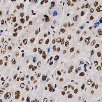 Polyclonal Rabbit anti-Human PELP1 Antibody (IHC)