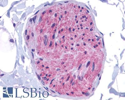 PathPlus™ GPR162 Antibody (Extracellular Domain)