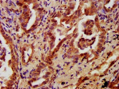 PRKCH / PKC-Eta Antibody