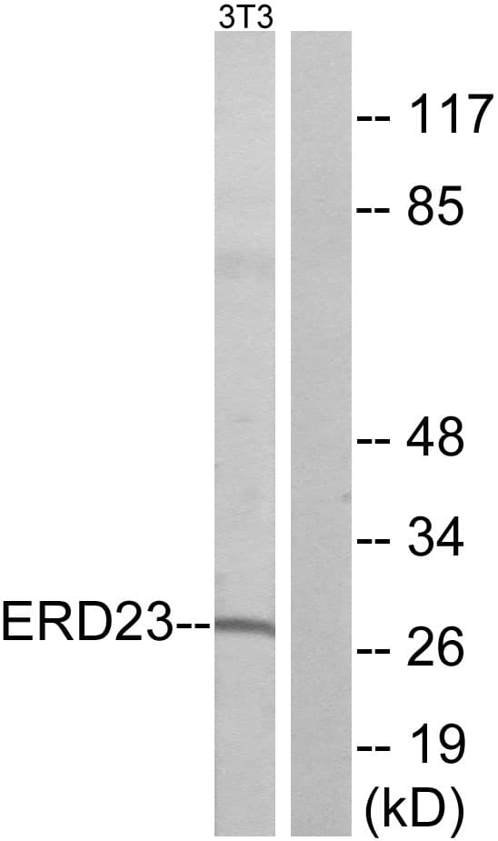 Polyclonal Rabbit anti-Human KDELR3 Antibody (aa61-110, WB)