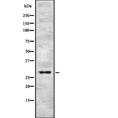 Polyclonal Rabbit anti-Human APOD / Apolipoprotein D Antibody (WB)