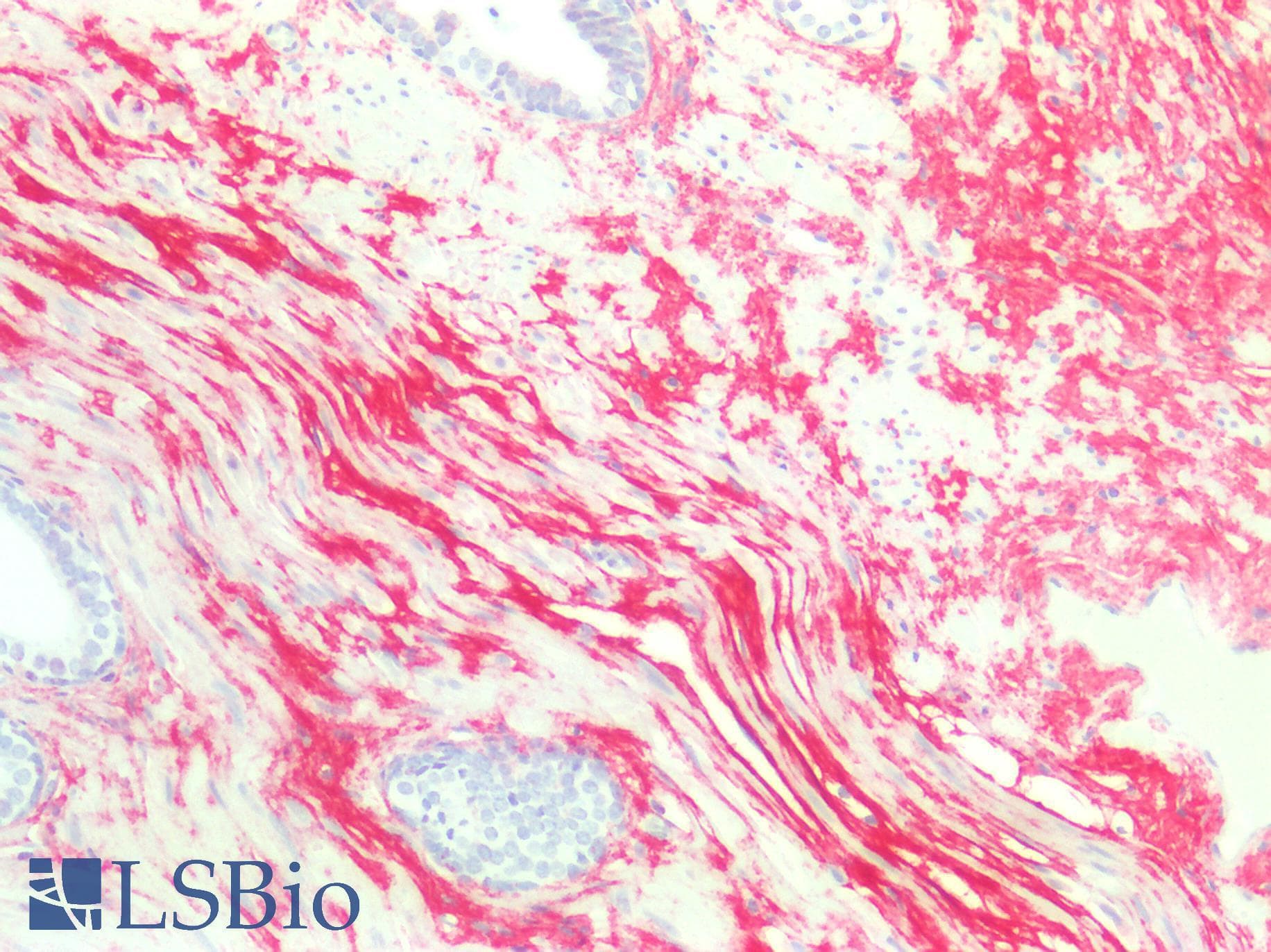 IHC-plus™ DCN / Decorin Antibody