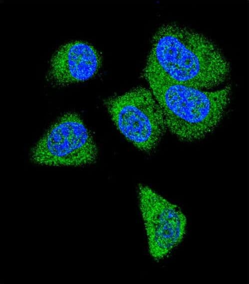 Complement C6 Antibody (aa30-58)