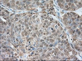 Monoclonal Mouse anti-Human GPI Antibody (clone OTI2D2, IHC, IF, WB)