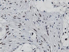 NT5DC1 Antibody (clone OTI3A6)