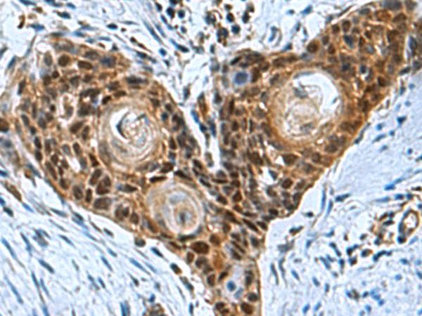 ITGB1BP1 / ICAP1 Antibody