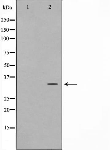 FOXE2 / FOXE1 Antibody