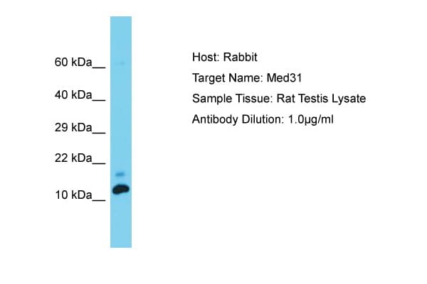 MED31 Antibody (C-Terminus)