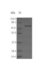 Human STK16 Protein (Recombinant GST, N-terminus)