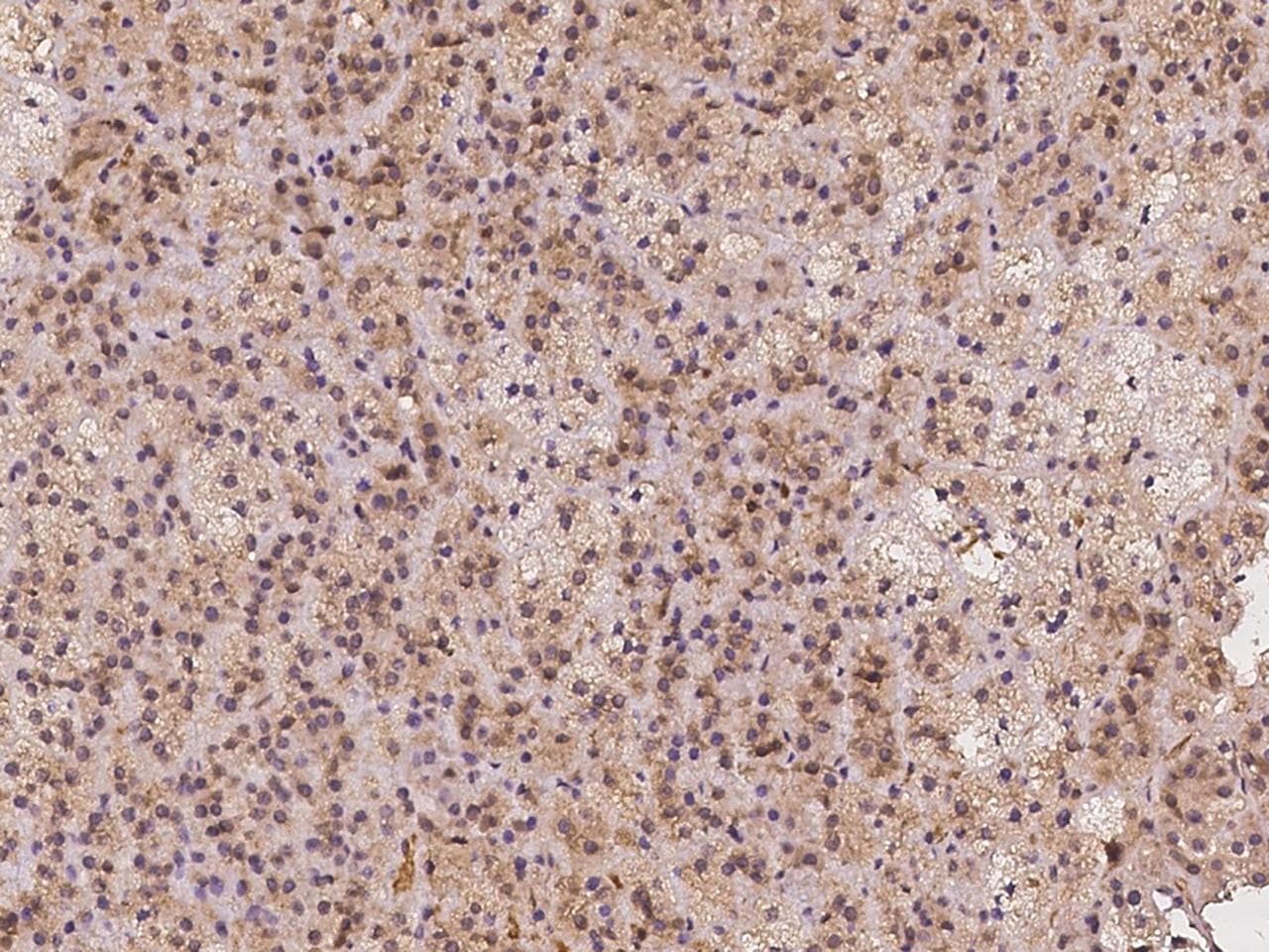 CDw218a / IL18R1 Antibody