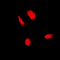 FANCC Antibody