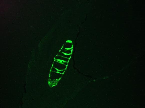 PathPlus™ Monoclonal Mouse anti-Human KRT13 / CK13 / Cytokeratin 13 Antibody (clone 1C7, IHC, WB)