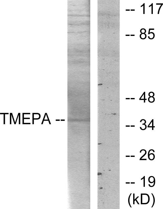 TMEPAI / PMEPA1 Antibody