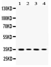 Polyclonal Rabbit anti-Human MC1R Antibody (WB)